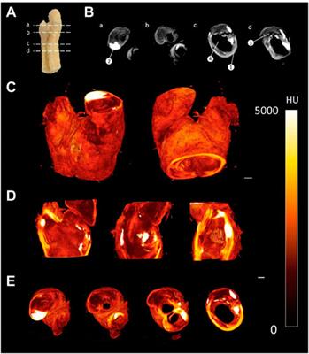 Phosphotungstic acid (PTA) preferentially binds to collagen- rich regions of porcine carotid arteries and human atherosclerotic plaques observed using contrast enhanced micro-computed tomography (CE-µCT)